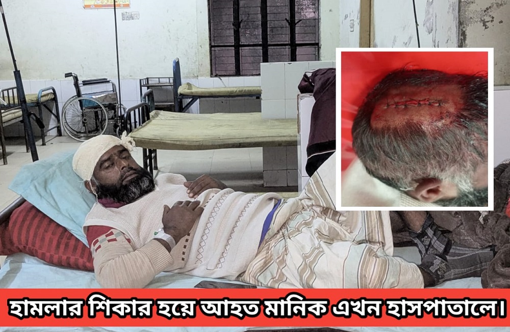 কুড়ালের কোপে আহত মামুন-মাথায় ১১ সেলাই